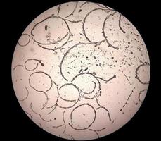 mikroskopisk bild som visar hyfer av dermatofyter,, hud skrapning för svamp testa foto
