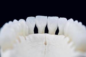 lägre mänsklig käke med tänder isolerat på svart bakgrund foto