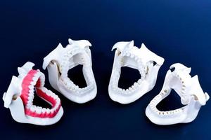 tandläkare ortodontisk tänder modeller foto