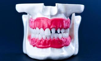 mänsklig käke med tänder och tandkött anatomi modell foto