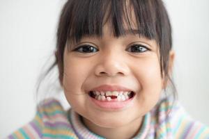 liten asiatisk flicka som visar henne bruten mjölk tänder. foto