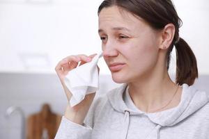 herpes på de näsa - Söt ung kvinna känner obehag av herpes på henne ansikte och innehar en näsduk. mänsklig virus. stänga upp av näsa med herpes simplex infektion och blåsor foto