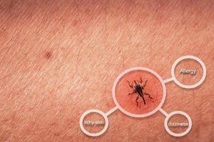 närbild Foto mänsklig hud med ett insekt uppflugen med fri Plats för bakgrund.