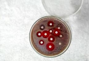 antimikrobiell känslighetstestning i petriskål. antibiotikaresistens hos bakterier foto