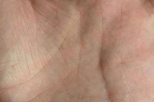stänga upp av mänsklig hand hud med synlig hud textur och rader foto