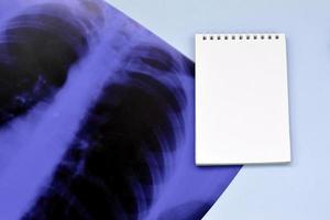 röntgen filma bild av mänsklig bröst för en medicinsk diagnos och tömma tom anteckningsblock sida på blå sjukhus tabell. platt lägga topp se foto