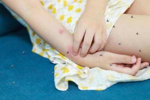 liten flicka har hud utslag allergi och kliande på henne ärm från mygga bita foto