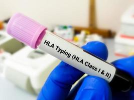 biolog innehav blod prov för hla skriver klass 1 och 2 testning pcr laboratorium. foto