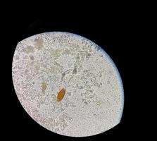ägg av trichuris trichiura piskmask i pall, analysera förbi mikroskop foto
