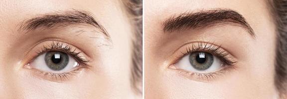 jämförelse av kvinna panna efter ögonbryn form korrektion foto