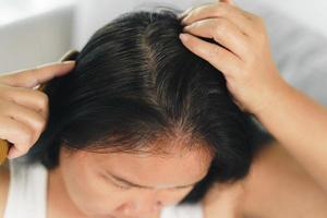 närbild asiatisk kvinna har problem med grå, vit hår foto