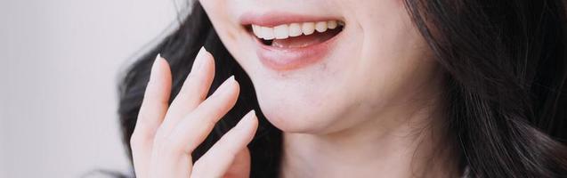 stomatologi begrepp, partiell porträtt av flicka med stark vit tänder ser på kamera och leende, fingrar nära ansikte. närbild av ung kvinna på tandläkare, studio, inomhus foto