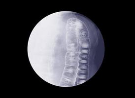 barium lavemang undersökning foto