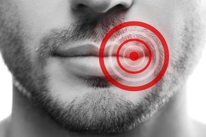 manlig mun med en röd cirklar. signal av problem sådan som kall sår. foto