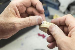 dental tekniker arbetssätt på 3d tryckt forma för tand implantat foto