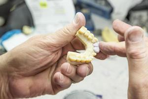 dental tekniker arbetssätt på 3d tryckt forma för tand implantat foto