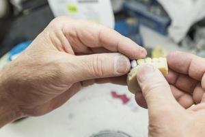 dental tekniker arbetssätt på 3d tryckt forma för tand implantat foto