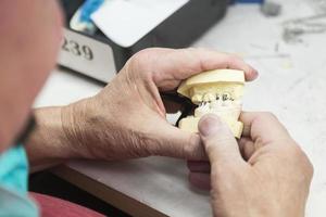 dental tekniker arbetssätt på 3d tryckt forma för tand implantat foto