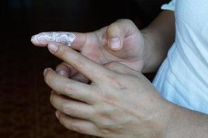närbild hand applicering medicinsk grädde på infektiös fingrar. begrepp, dermatit behandling. fingrar med svamp, bakteriell eller inflammatorisk. sjukvård och hed problem. foto