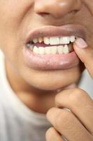 Tonårs pojke med känslig tänder foto