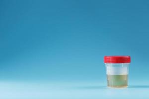 urin i en testa behållare med en röd lock på en blå bakgrund. sjukvård och medicinsk begrepp. foto