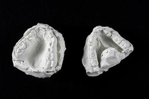 tänder kasta forma av de käke tillverkad av plåster för ortodonist arbete foto