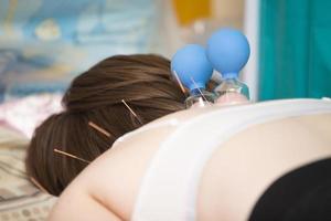 de läkare gör de patient akupunktur och Vakuum massage. foto