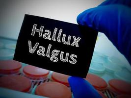 hallux valgus, medicinsk konceptuell bild. foto