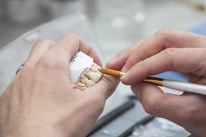 tillverkning av tandproteser. dental tekniker fixering en tandprotes foto