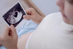 gravid kvinna är ser på ett ultraljud Foto av foster. mor försiktigt finputsning de bebis på mage. Lycklig, familj, tillväxt, graviditet, njutning , förbereda nyfödd, ta vård, sjukvård, mage.