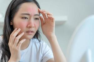 ung kvinna asiatisk är orolig handla om ansikten dermatologi och allergisk till steroider i kosmetika. känslig hud, röd ansikte från solbränna, acne, allergisk till kemikalier, utslag på ansikte. hud problem och skönhet foto