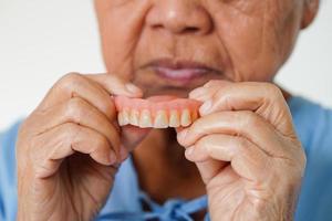 asiatisk senior kvinna patient innehav tänder tandprotes i henne hand för Tugga mat. foto
