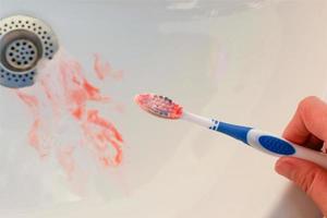 blod på tandborste på bakgrund av handfat. foto