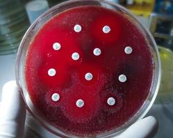 antimikrobiell känslighetstestning i petriskål. antibiotikaresistens hos bakterier foto