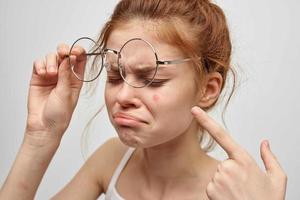 rödhårig kvinna bär glasögon finne på ansikte dermatologi hud vård foto