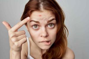 kvinna med finne på henne ansikte känslor hygien kosmetologi foto