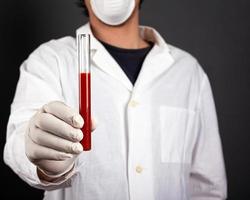 läkare i en vit kappa med engångshandskar och en medicinsk mask som håller ett provrör i handen med infektiöst blod. foto