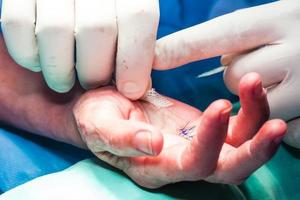 kirurg bandage de hand av en patient på de slutet av kirurgi foto