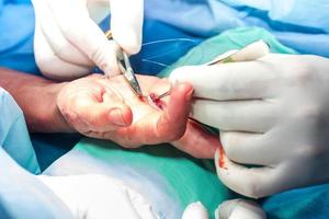kirurg suturering de hand av en patient på de slutet av kirurgi foto