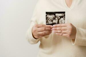 gravid kvinna innehav ultraljud filma av henne bebis. Lycklig mor och nyfödd bebis i bearbeta. kärlek av föräldrar till spädbarn i få månader innan ge födelse. foto