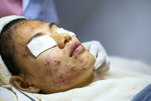 ung kvinna brådskande finnar på de klinik. problem den där kvinnor oroa handla om hud inflammation. skönhet i kvinnor. foto