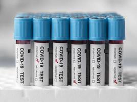 blodprover för covid test i lab foto