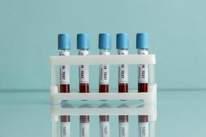 blodprover för covid test i lab foto