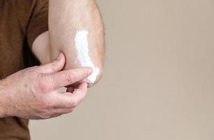 psoriasis salva behandling av huden