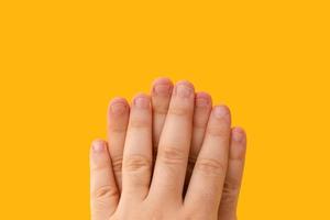 fingrar med bitna naglar isolerad på en gul bakgrund foto