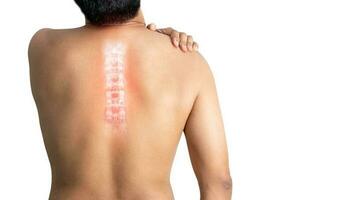 inflammerad mänsklig ryggrad smärta av vit bakgrund foto