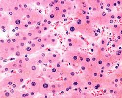 polyploidkärnor hepatocyter foto