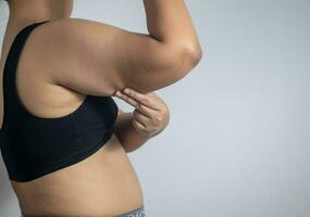fett kvinna hand innehav fett på ärm, hälsa vård begrepp foto