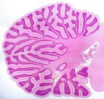 cerebellum sagittal sektion foto