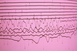 magnitudlinjer på lila papper foto